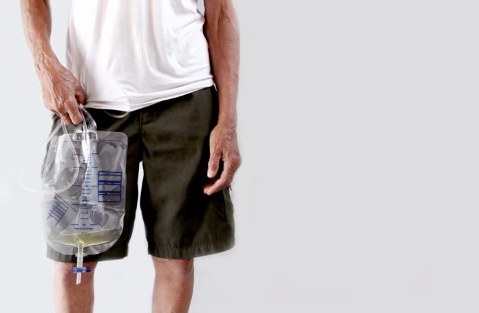 man standing with catheter bag